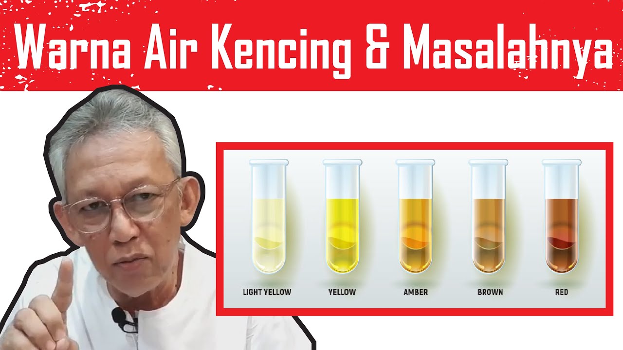 11 WARNA AIR KENCING & Apa Masalahnya? Termasuk yang BERBUIH