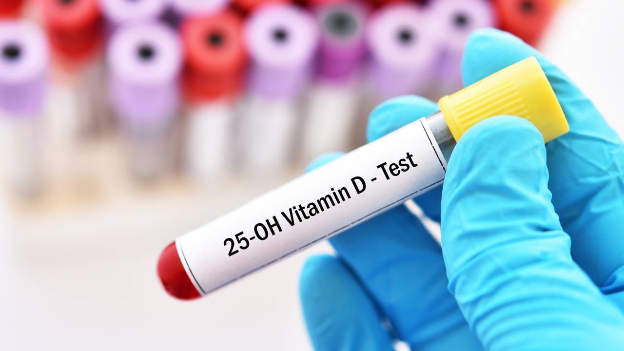 Cek Kadar Vitamin D Manfaat Prosedur Harga cek-kadar-vitamin-d-manfaat-prosedur-harga