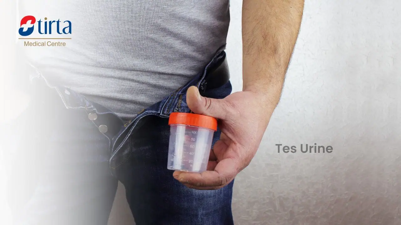 Tes Urine