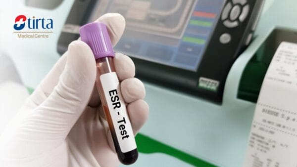 High Erythrocyte Sedimentation Rate (ESR) - Causes, Types, & Results