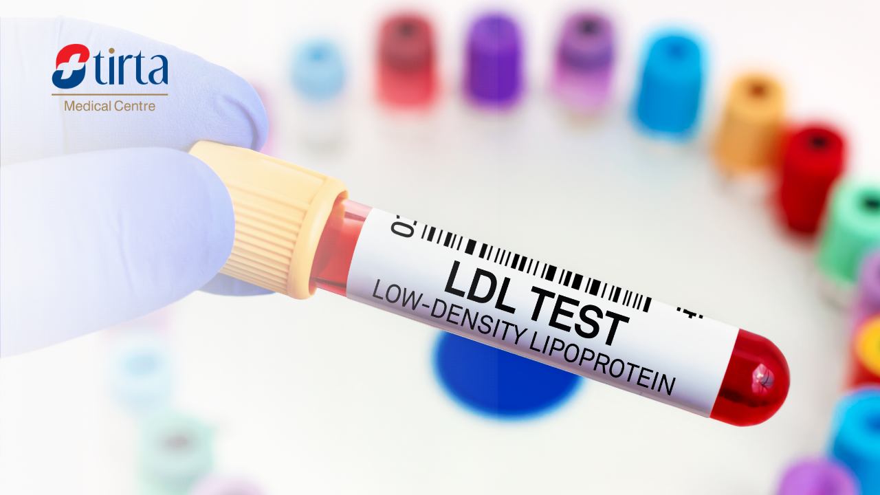 Kolesterol LDL