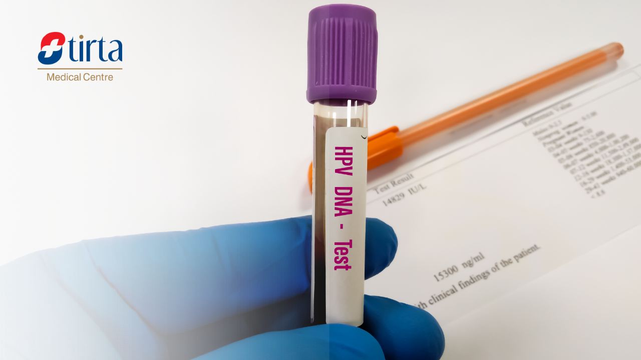 Tes HPV DNA