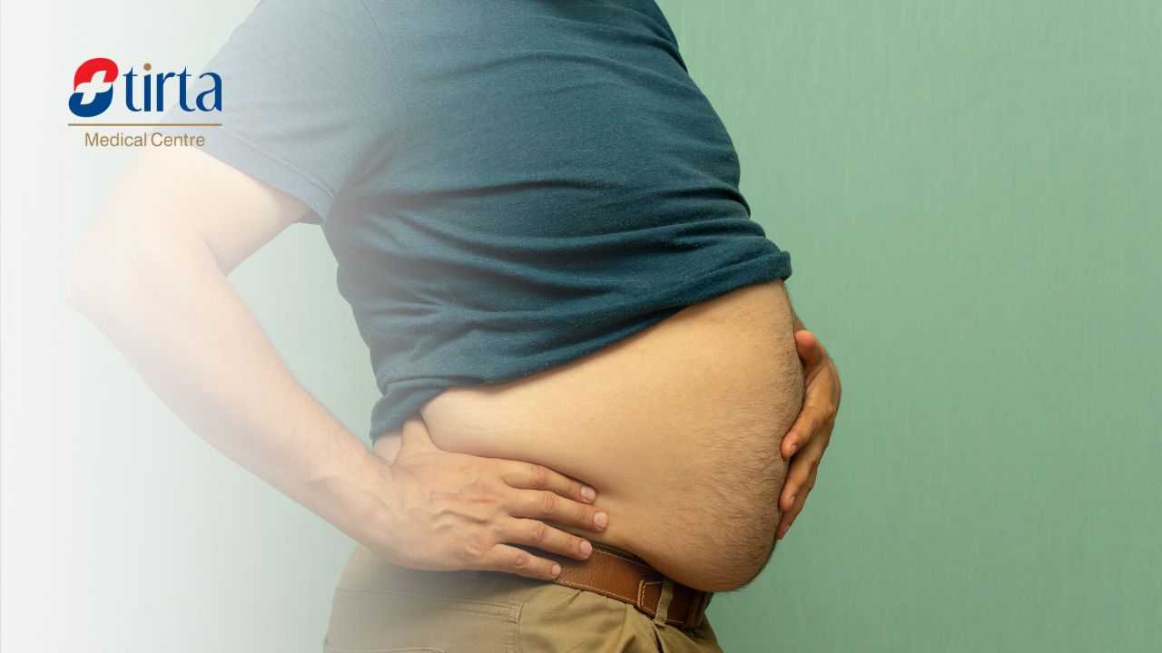 Cara Mengecilkan Perut Buncit