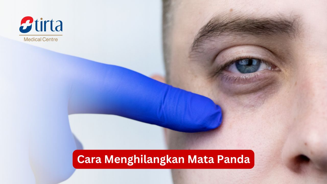 Cara Menghilangkan Mata Panda
