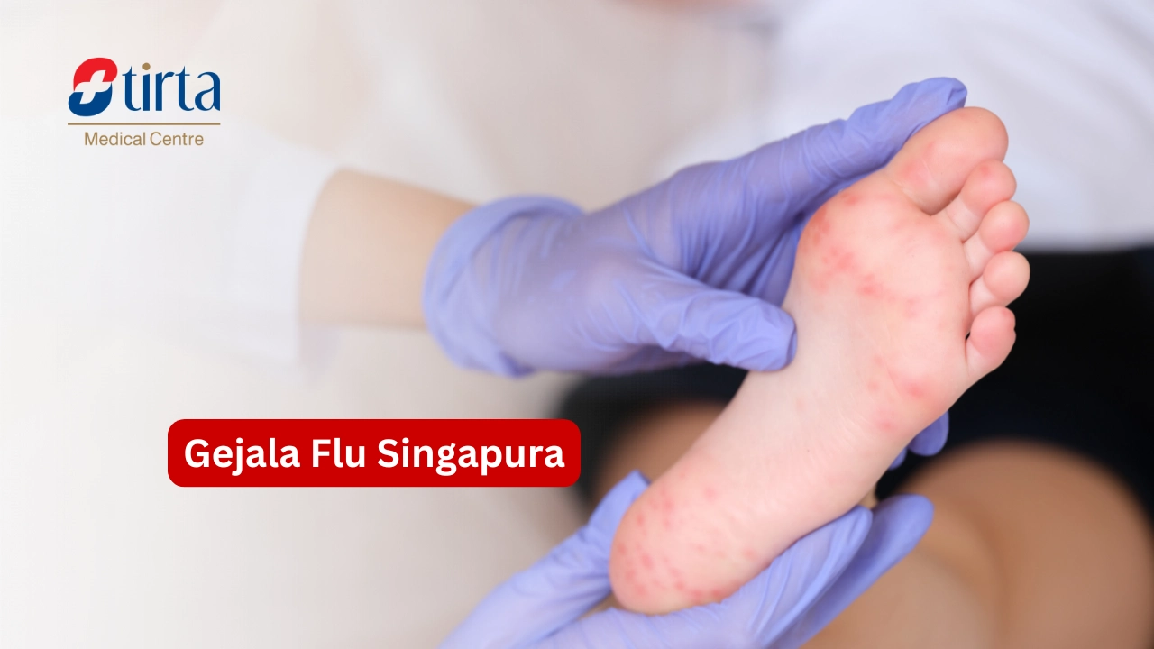 Gejala Flu Singapura