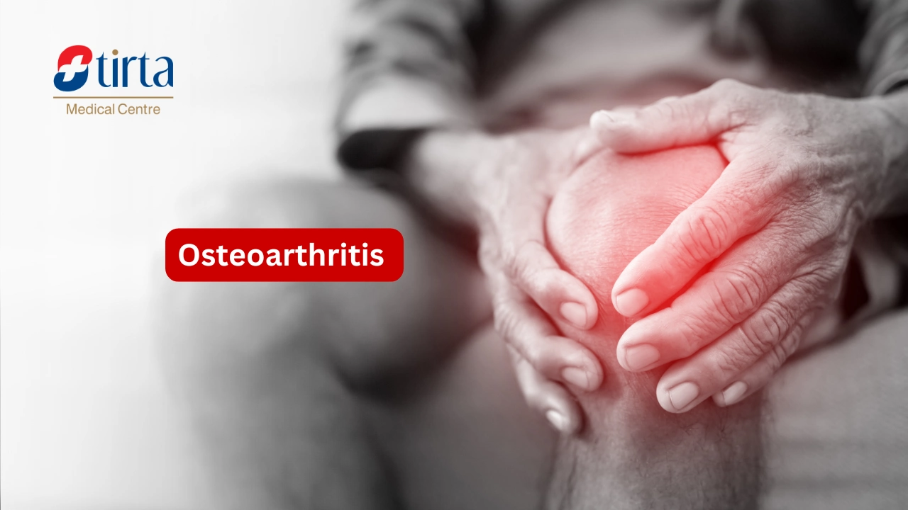 Osteoarthritis
