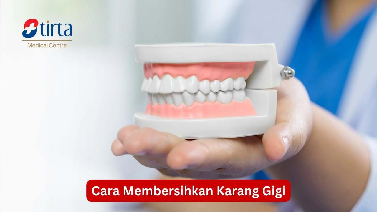 Cara Membersihkan Karang Gigi