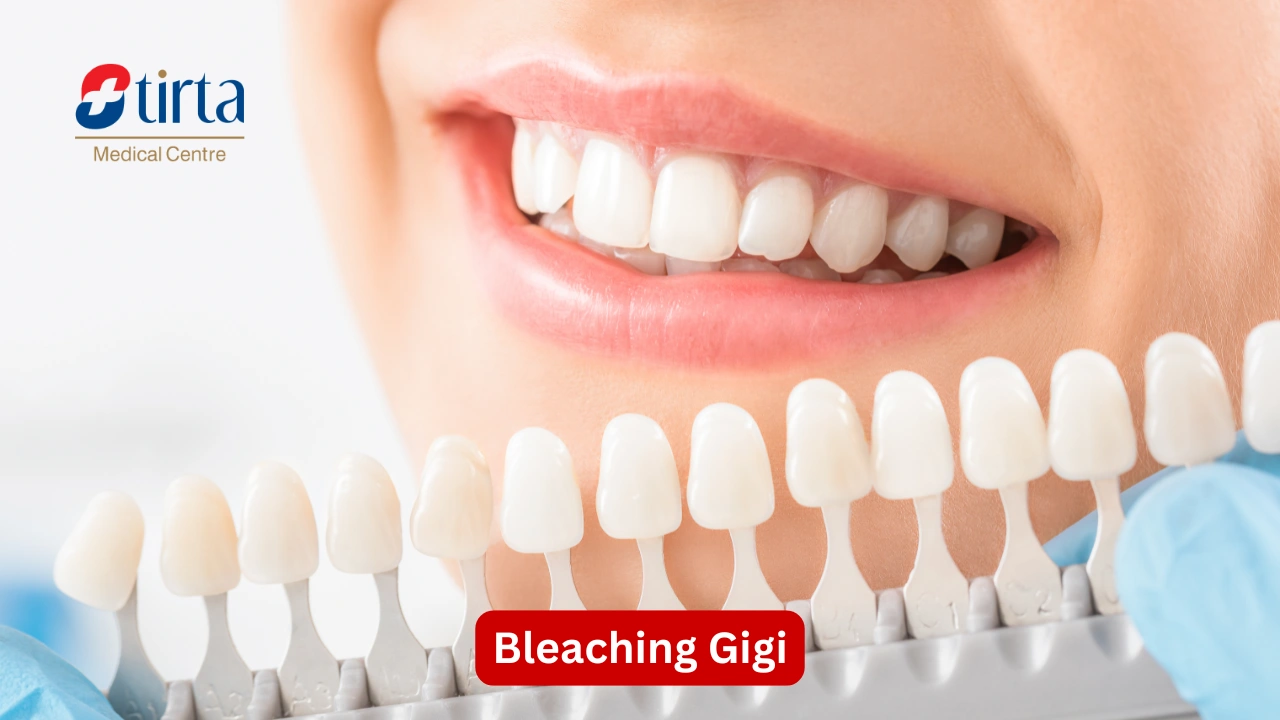 Bleaching Gigi